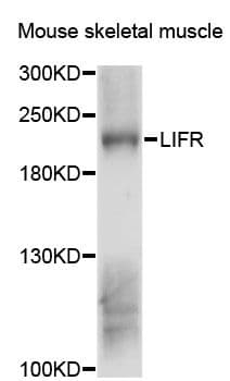 Polyclonal Rabbit anti-Human CD118 / LIF Receptor Alpha Antibody (WB)
