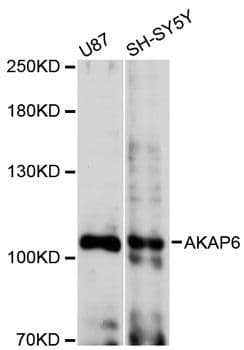 Polyclonal Rabbit anti-Human AKAP6 / MAKAP Antibody (WB)