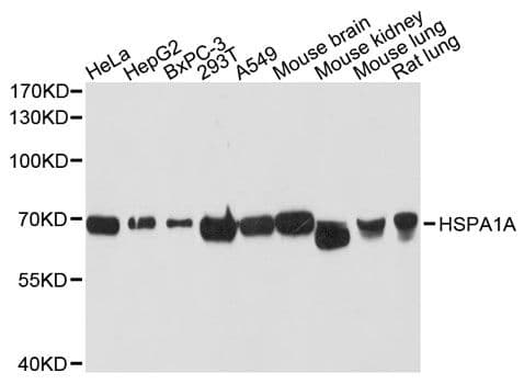 Polyclonal Rabbit anti-Human HSPA1A Antibody (WB)