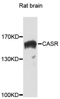 Polyclonal Rabbit anti-Human CASR/Calcium Sensing Receptor Antibody (WB)