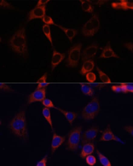 Polyclonal Rabbit anti-Human IGF2R / CD222 Antibody (IHC, IF, WB)