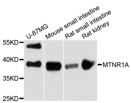 Polyclonal Rabbit anti-Human MTNR1A / Melatonin Receptor 1a Antibody (IHC, WB)