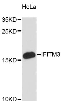 Polyclonal Rabbit anti-Human Fragilis / IFITM3 Antibody (WB)