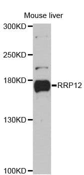 Polyclonal Rabbit anti-Human RPRD2 Antibody (WB)