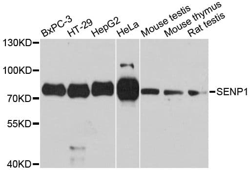 Polyclonal Rabbit anti-Human SENP1 Antibody (WB)