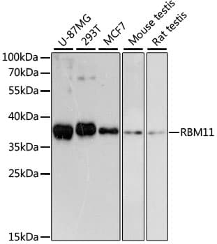 Polyclonal Rabbit anti-Human RBM11 Antibody (WB)