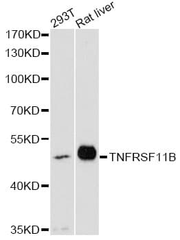 Polyclonal Rabbit anti-Human OPG / Osteoprotegerin Antibody (WB)