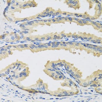 CST3 / Cystatin C Antibody