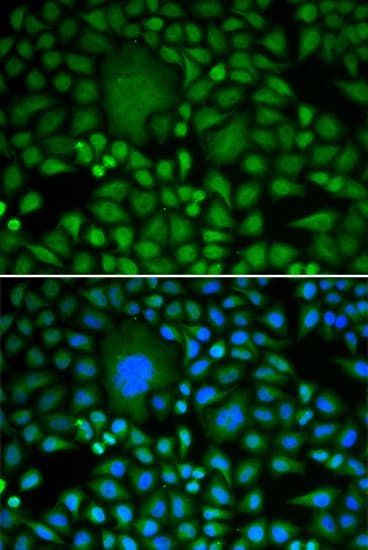 Polyclonal Rabbit anti-Human DDX5 Antibody (IHC, IF, WB)