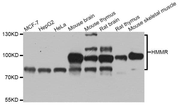 Polyclonal Rabbit anti-Mouse HMMR / CD168 / RHAMM Antibody (WB)