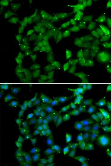 Polyclonal Rabbit anti-Human PRKAB2 / AMPK Beta 2 Antibody (IHC, IF, WB)