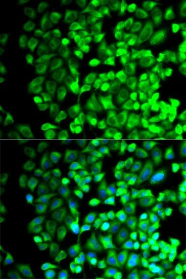 Polyclonal Rabbit anti-Human TS / Thromboxane Synthase Antibody (IHC, IF, WB)