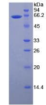 Human MMP2 Protein (Recombinant His, N-Terminal)