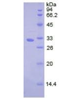 Human CTSV / Cathepsin V Protein (Recombinant His, N-Terminal)