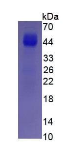 Human MBP / Myelin Basic Protein (Recombinant His, N-Terminal)