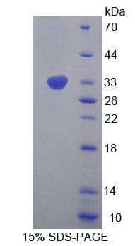 Human EIF2S1 Protein (Recombinant His-T7, N-terminus)