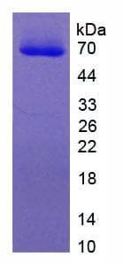 Human MITF Protein (Recombinant His, N-Terminal)