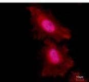 FOXO1 / FKHR Antibody (aa242-655, clone 7H3)