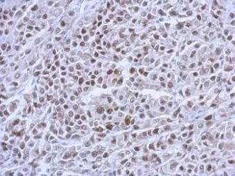 Monoclonal Mouse anti-Human TP53 / p53 Antibody (aa14-389, IHC, WB)