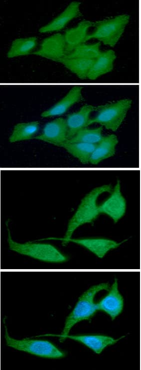 Monoclonal Mouse anti-Human CRADD / RAIDD Antibody (clone AT14G8, WB)