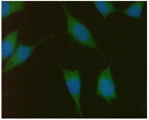 Monoclonal Mouse anti-Human PMVK Antibody (clone AT21C10, WB)