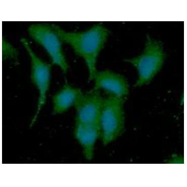 Monoclonal Mouse anti-Human DYNLL1 / PIN Antibody (clone AT13C9, WB)