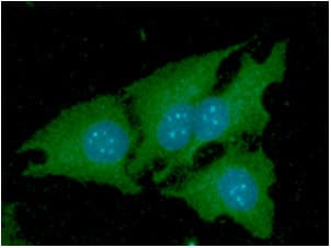 Monoclonal Mouse anti-Human NNMT Antibody (clone AT11G11, WB)