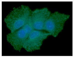 SOD1 / Cu-Zn SOD Antibody (clone AT6F1)