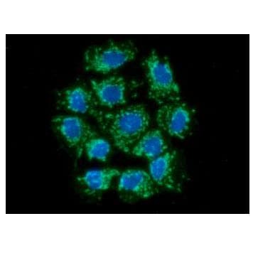 Monoclonal Mouse anti-Human AIFM1 / AIF / PDCD8 Antibody (clone AT22E9, WB)