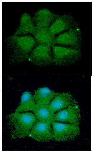 CDKN1B / p27 Kip1 Antibody (clone AT7B9)