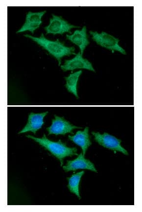 Enolase Antibody (clone AT1G7)