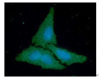 Monoclonal Mouse anti-Human CKB / Creatine Kinase BB Antibody (clone AT8E4, WB)