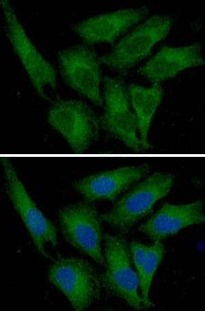 Monoclonal Mouse anti-Human SERPINE1 / PAI-1 Antibody (clone AT1C5, WB)