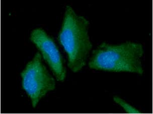 Monoclonal Mouse anti-Human Alpha-Fetoprotein Antibody (clone AT73E10, WB)