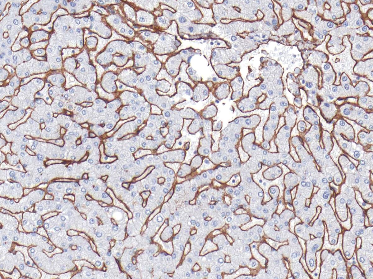 Collagen IV Antibody (Ready-to-Use)