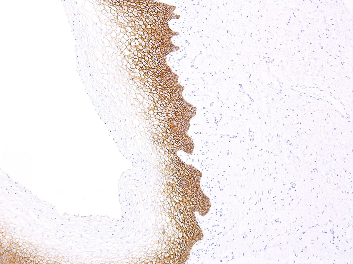 CDH1 / E Cadherin Antibody (Ready-to-Use)