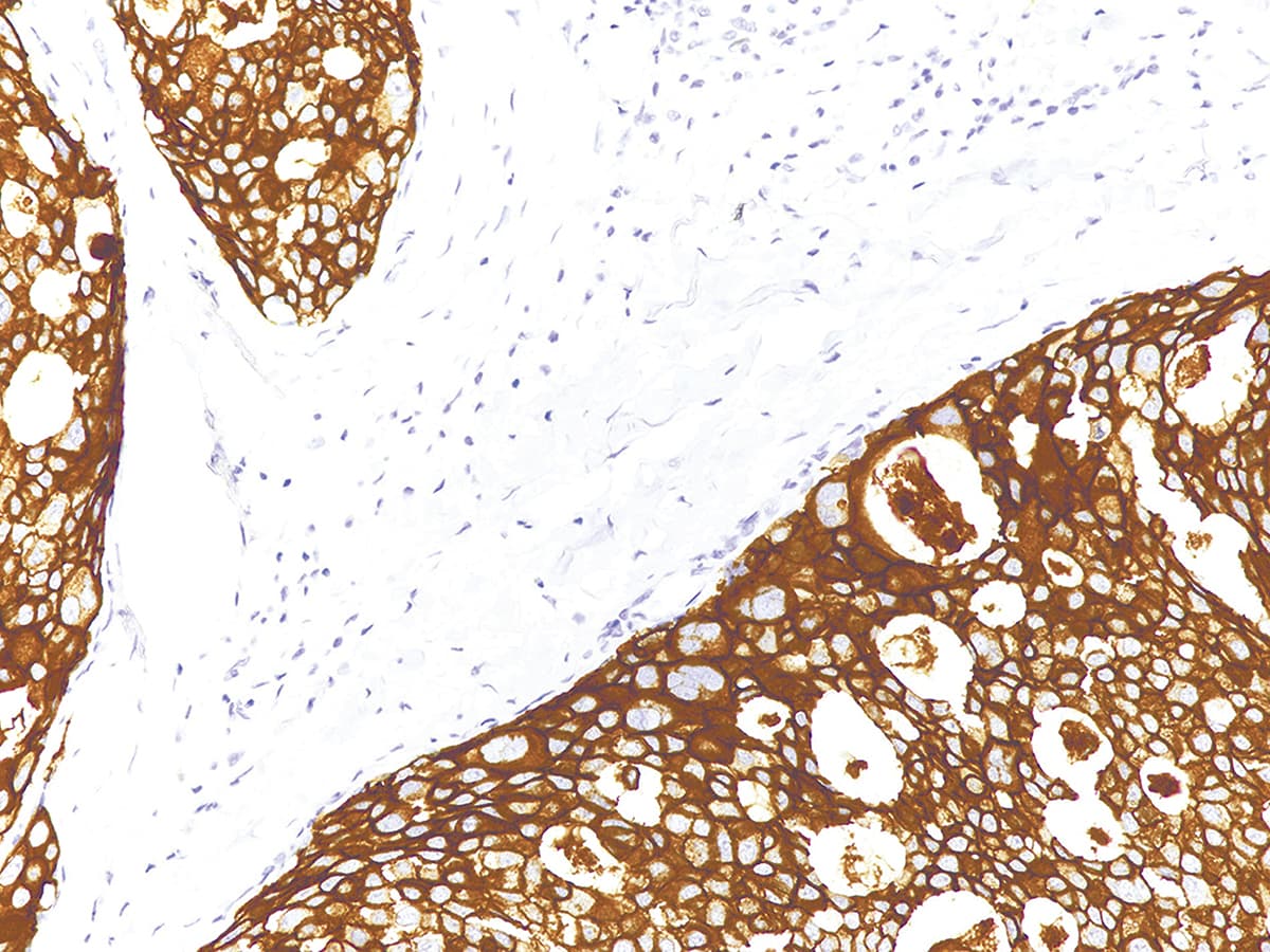 ERBB2 / HER2 Antibody (Ready-to-Use)