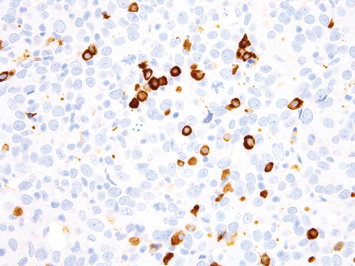 Ig Kappa Light Chain Antibody (Ready-to-Use)