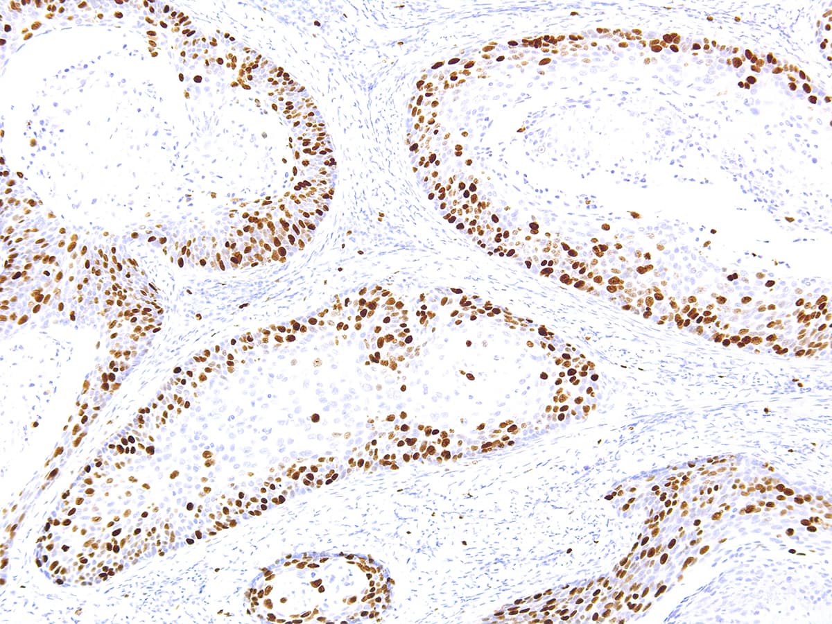 MKI67 / Ki67 Antibody (Ready-to-Use)