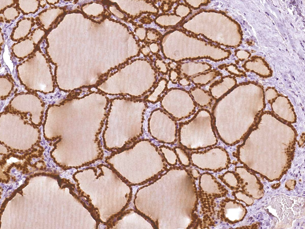 PAX8 Antibody (Ready-to-Use)