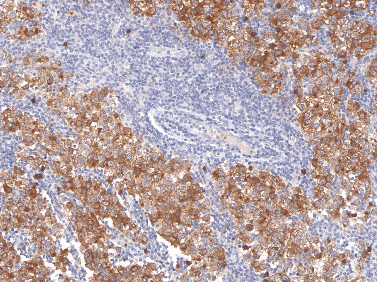 PDPN / Podoplanin Antibody (Ready-to-Use)