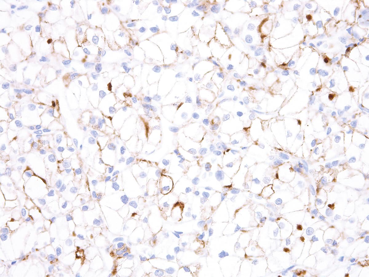 HAVCR2 / TIM-3 Antibody (Ready-to-Use)