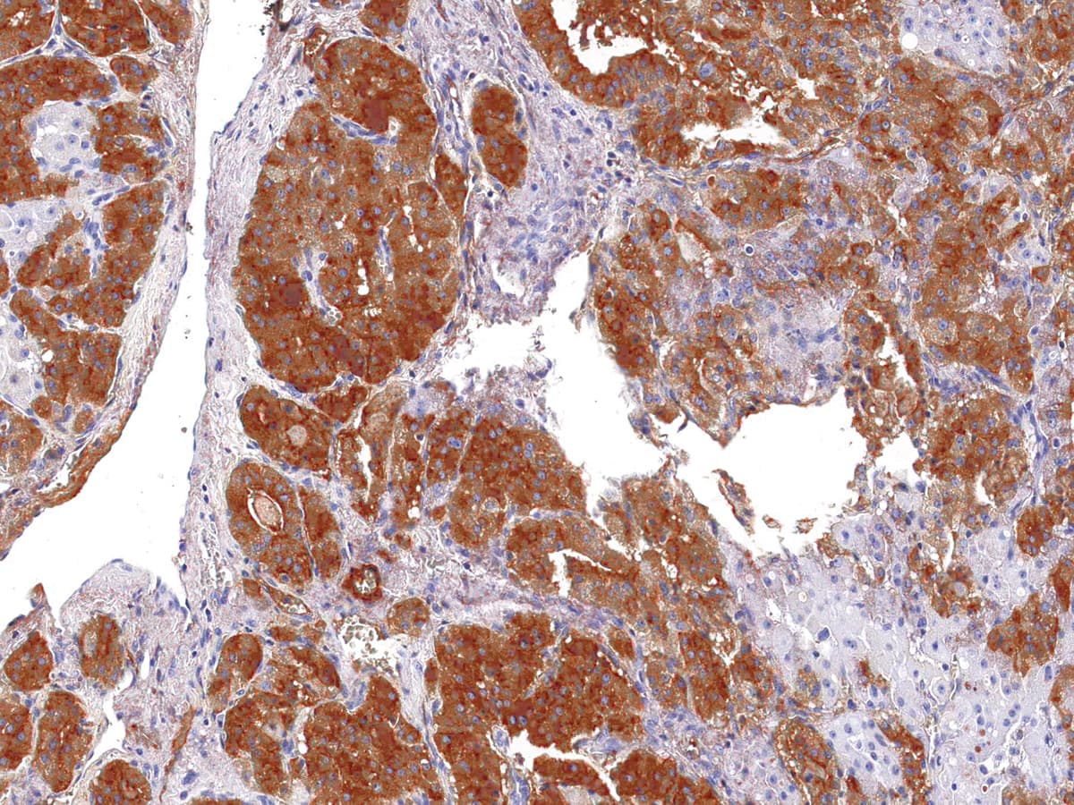 TG / Thyroglobulin Antibody (Ready-to-Use)
