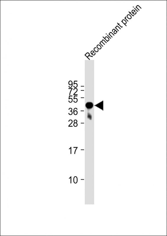 Monoclonal Mouse anti-Human FAT4 Antibody (clone 1654CT645.1.70, WB)