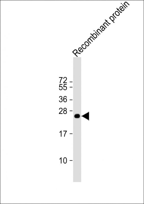 KMT2C / MLL3 Antibody (clone 1686CT202.60.69)