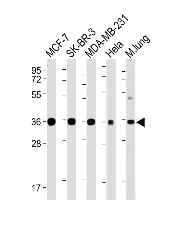 WNT4 Antibody (clone 1698CT540.169.185)