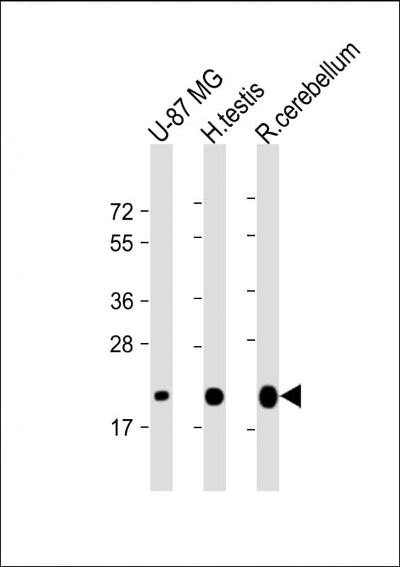Monoclonal Mouse anti-Human CD81 Antibody (clone 1668CT178.9.24.87, WB)