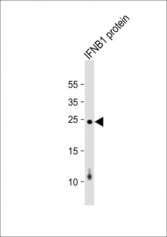 Monoclonal Mouse anti-Human IFN Beta / Interferon Beta Antibody (clone 1394CT509.46.3, WB)
