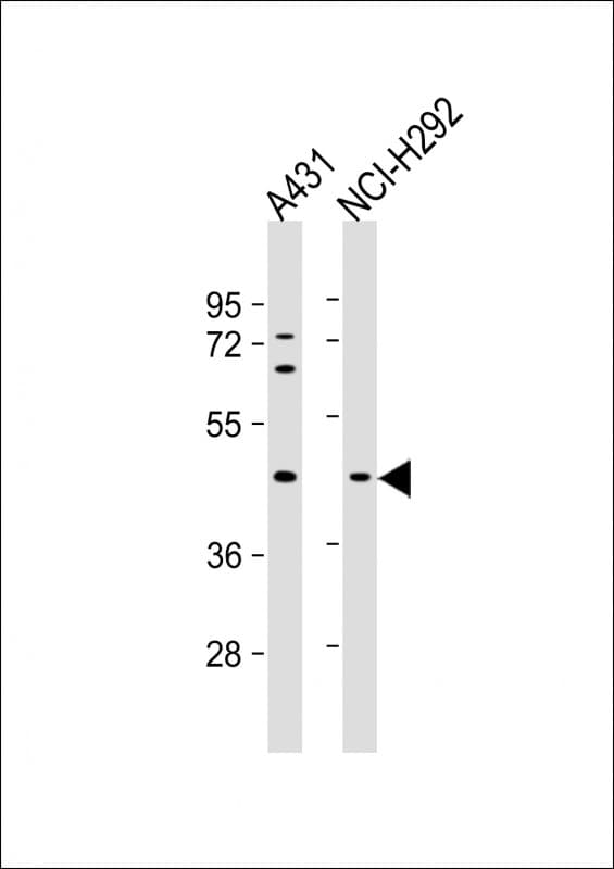 Monoclonal Mouse anti-Human SERPINB3 Antibody (clone 798CT5.2.2, WB)