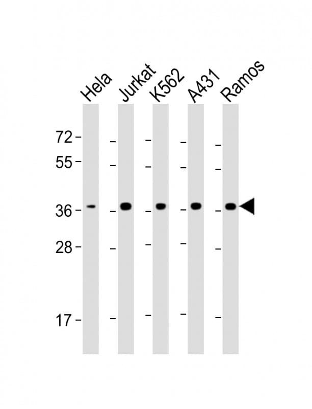 RAD51 / RECA Antibody (clone 1690CT361.33.68)
